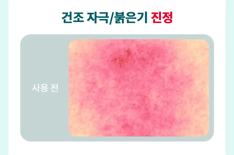 [속건조/진정보습] 닥터지 레드 블레미쉬 클리어 모이스처 크림 70ml 기획 (+30ml 증정) 상세페이지 13